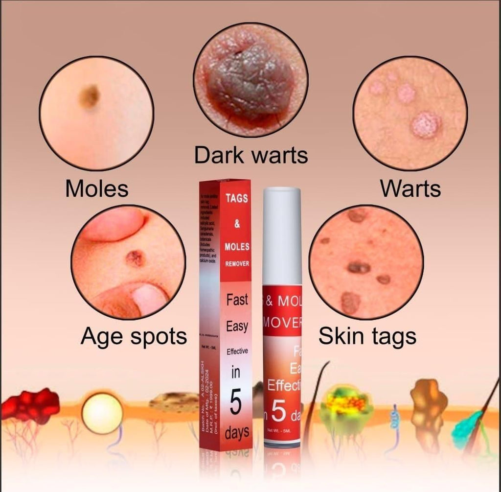 Zero-spot Cream – Gentle Tag & Mole Corrector Cream (Pack of 2 - 5ml each)