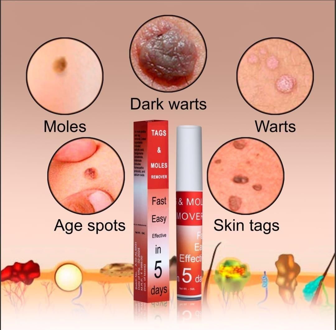 Zero-spot Cream – Gentle Tag & Mole Corrector Cream (Pack of 2 - 5ml each)